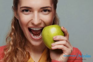 ¿Necesitas ortodoncia? Tipos de tratamientos