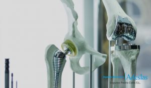 Implantes y prótesis quirúrgicas con tu seguro médico Adeslas