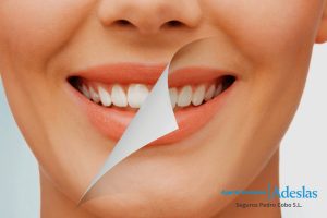 Blanqueamiento dental precio