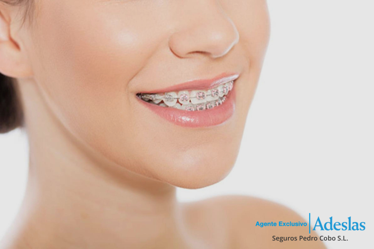 Mujer sonriendo con ortodoncia