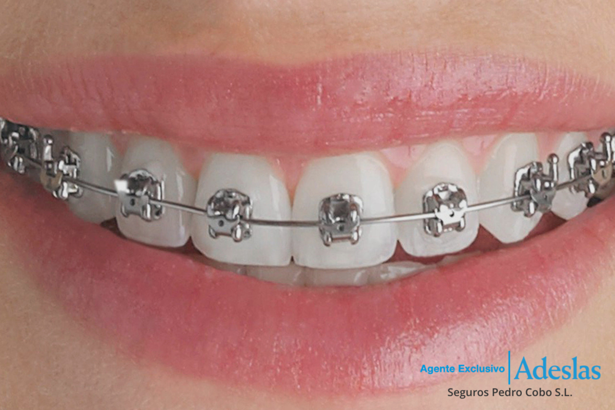 Sonrisa con ortodoncia